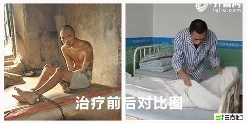 “破坏男”经过治疗变了样 父子见面惊喜相拥